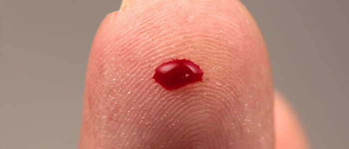 Цей аналіз крові передбачає ймовірність близької смерті