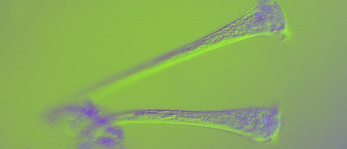 Ця одноклітинна істота на диво розумна