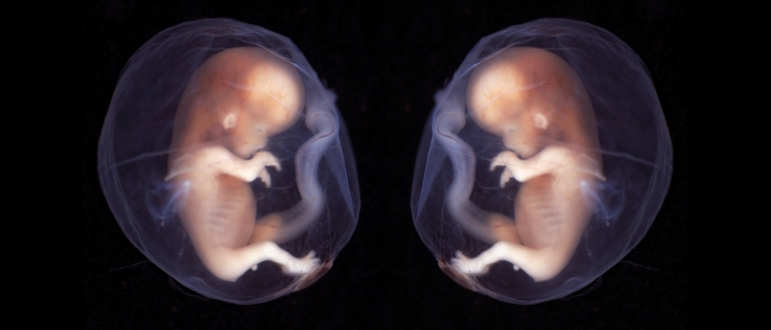 Близнюки народилися з донорських ембріонів, заморожених у 1992 році