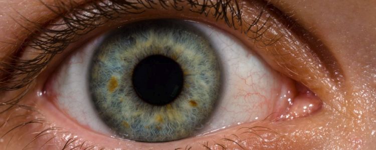 Використання «нанокрапель» для ремонту рогівки може в кінцевому підсумку замінити окуляри