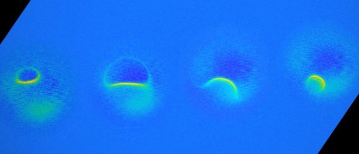 Найменша в світі машина МРТ сканує окремі атоми