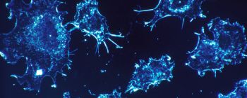 Дослідження показує, що 40% випадків раку можна повністю запобігти