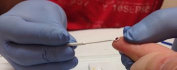 Новий тест використовує одну краплю крові для скринінгу на 13 типів раку