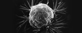 Прорив у генетиці може привести нас до способу відстеження і знищення раку