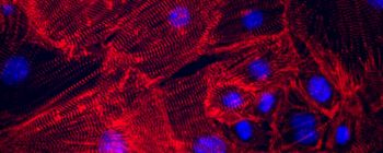 Нові свідчення вказують на те, що регенерація серця людини можлива