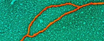 Тепер ви можете дізнатися, якщо ваша ДНК піддає вас більшому ризику захворювань