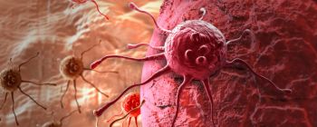 Новий метод лікування знищив ракову пухлину молочної залози протягом 11 днів без хімії