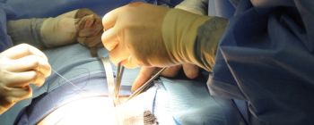 Вчені знайшли спосіб радикально скоротити рубцювання, завдяки морським істотам