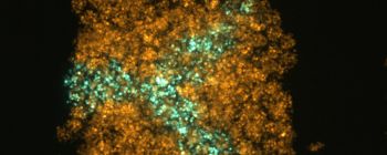 Вчені розробили новий метод для 3D-друку живої тканини