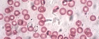 Новий паперовий тест може визначити ваш тип крові всього за 30 секунд