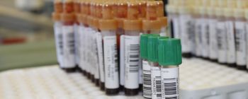 Дві дитини позбулися раку після лікування з застосуванням редагування генів