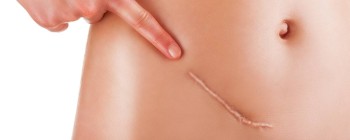 Кінець рубцям: вчені з'ясували, як відновити людську шкіру