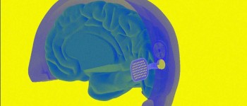 Біонічне око дозволяє бачити чоловіку, що осліп після нещасного випадку