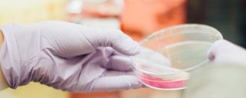 Таємнича бактерія може бути важливою частиною раку