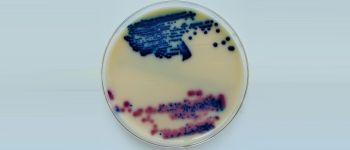 У нас новий антибіотик, і ми можемо створити його в лабораторії