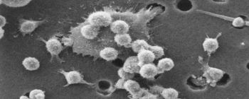 Новий спосіб лікування раку може бути більш ефективним, ніж хіміотерапія