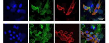 Дослідники розробляють нову протиракову вакцину за допомогою вірусоподібних часток