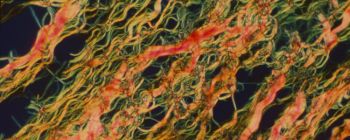 Нове відкриття щодо людської шкіри може допомогти нам усунути рубці