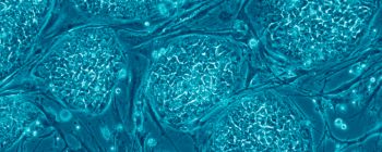 Нова терапія стовбуровими клітинами показує «вражаючі» результати у боротьбі зі старінням