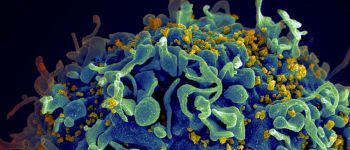 Вже третій пацієнт вилікуваний від ВІЛ