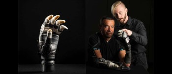 Ручний протез зі штучним інтелектом інтуїтивно захоплює предмети