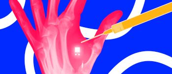 Останній тренд Швеції: введення мікрочипів під шкіру