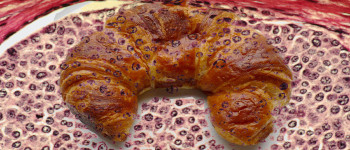 Алгоритм тренований на випічці відмінно допомагає виявляти рак