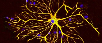 Вчені виявили систему очищення мозку, яка руйнується при хворобі Альцгеймера