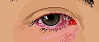 Користувачі Apple Vision Pro повідомляють про головні болі та розрив кровоносних судин