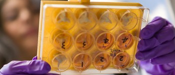 Вчені працюють над створенням біокомп'ютерів із вирощених у лабораторії «мінімозків»