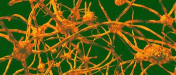 Пересадка кісткового мозку може запобігти старінню