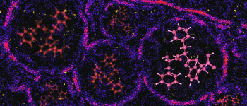 Нова технологія змушує ракові пухлини світитися