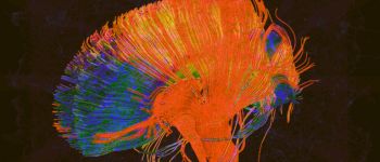 Хіміки виростили «синтетичний мозок», який зберігає спогади в сріблі