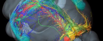 Нове лікування хвороби Альцгеймера може остановити дегенерацію синапсів і втрату пам'яті 