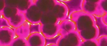 Смертельний «супер грибок» може стати початком глобальної епідемії