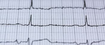 Стоматологи тепер стежать за стресовими навантаженнями пацієнтів