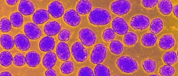 Діабетичні миші «швидко виліковуються» за допомогою стовбурових клітин людини