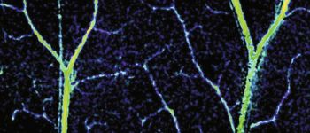 Лікарі тепер можуть детально вивчити ваші капіляри