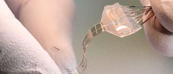 Електростимуляція допомогла людині з паралізованими ногами знову ходити