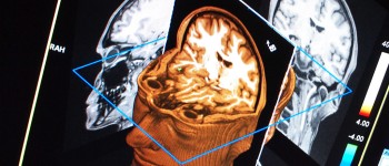 Еволюція могла обмежити розмір людського мозку, щоб збалансувати енергетичні витрати