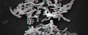 Нарешті, штучний інтелект робить щось корисне: бореться з лікарняними інфекціями