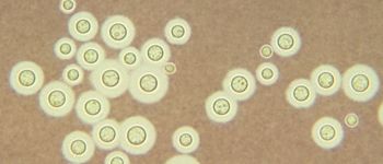 Зростаючий в Чорнобилі грибок може захистити астронавтів від космічних променів