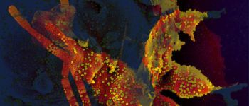 Хороша новина: людський організм виробляє «стійку» імунну відповідь на коронавірус