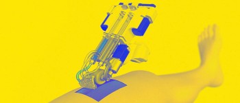 Портативний пристрій «друкує» нову шкіру прямо на рани