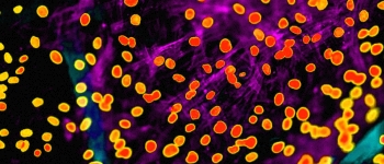 У Гарварді модифікували стовбурові клітини всередині живого організму