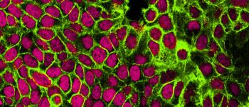 Ізраїльські вчені впевнені, що матимуть ліки проти раку протягом року 