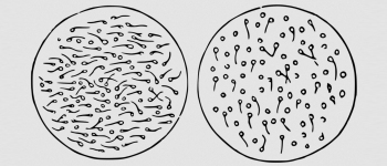 Різке падіння кількості сперматозоїдів може «загрожувати виживанню людства»