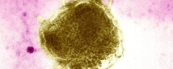 Офіційно: кір повністю ліквідовано в Сполучених Штатах