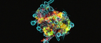 Дослідники кажуть, що мікроби збираються в «надорганізми», які повзають вашими зубами