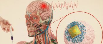 В МТІ винайшли ін'єкційні мозкові чипи
